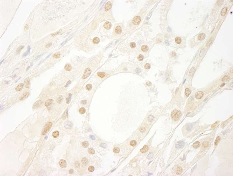 MYBL2 Antibody (aa450-500)