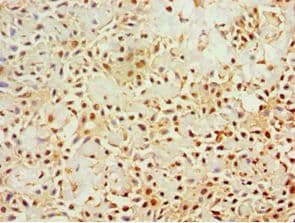 Polyclonal Rabbit anti-Human KLRC1 / NKG2A / CD159a Antibody (aa114-233, IHC)