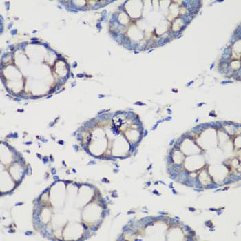 Polyclonal Rabbit anti-Human GLUD1/Glutamate Dehydrogenase Antibody (IHC, WB)