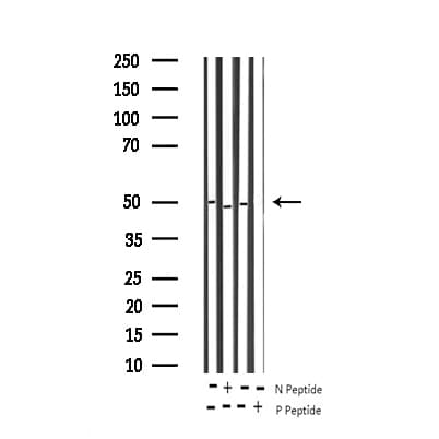 AML1 / RUNX1 Antibody (phospho-Ser276)