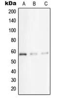 Polyclonal Rabbit anti-Human STK33 Antibody (N-Terminus, IHC, WB)