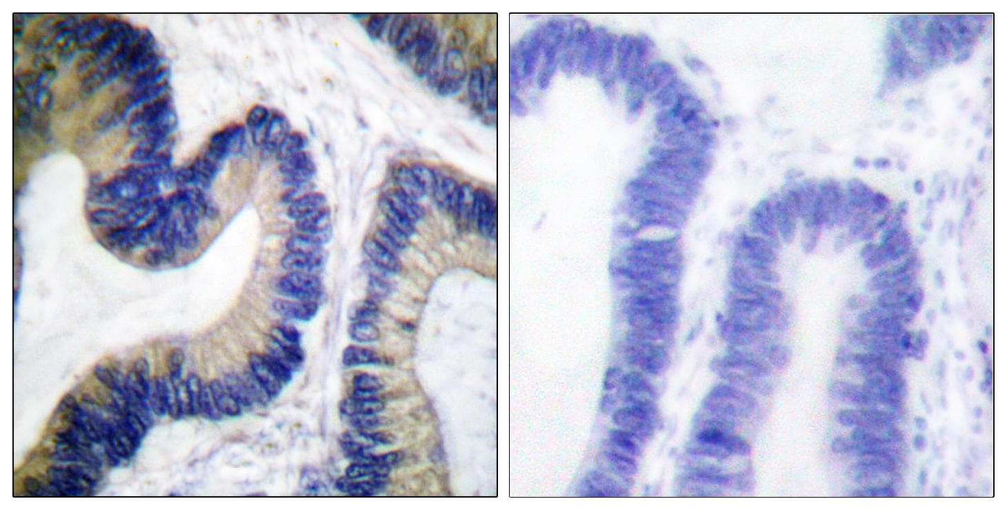 Polyclonal Rabbit anti-Human EIF4EBP1 / 4EBP1 Antibody (phospho-Ser64, IHC, WB)