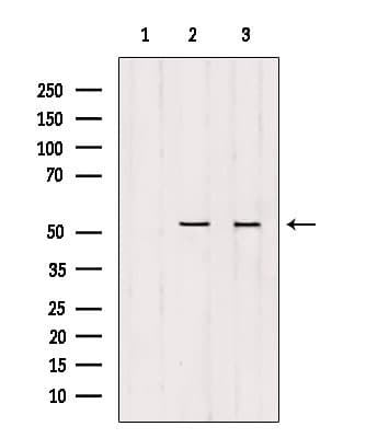 GSS / Glutathione Synthetase Antibody