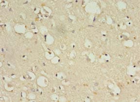 ZNF699 Antibody