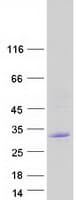 Human CABP / CABP1 Protein (Recombinant Myc-DDK (Flag))