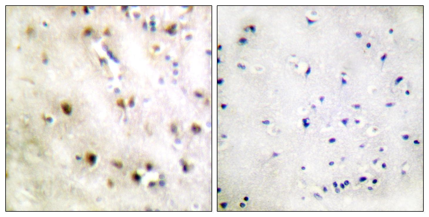 Polyclonal Rabbit anti-Human ZFP36L1 Antibody (p92, IHC, WB)