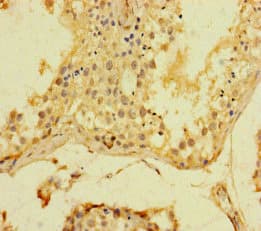 SRF / Serum Response Factor Antibody