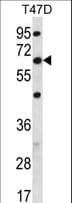 Polyclonal Rabbit anti-Human FAM83D Antibody (aa357-385, WB)