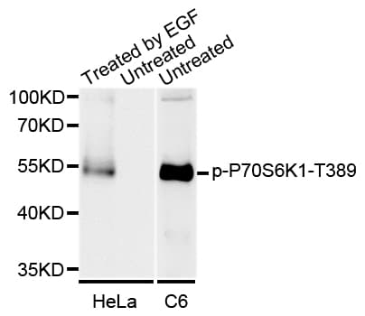 Polyclonal Rabbit anti-Human RPS6KB1 / P70S6K / S6K Antibody (phospho-Thr389, WB)