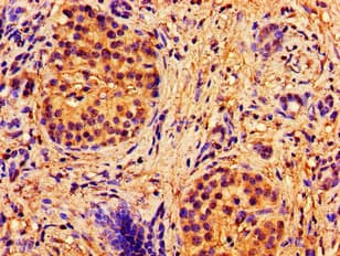 Polyclonal Rabbit anti-Human ABCB7 Antibody (IHC)