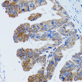 TOPBP1 Antibody