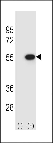 Polyclonal Rabbit anti-Human TIP48 / RUVBL2 Antibody (aa400-430, WB)