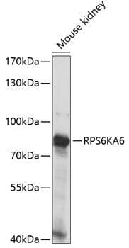 RPS6KA6 / RSK4 Antibody