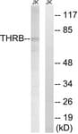 IHC-plus™ Polyclonal Rabbit anti-Human F2 / Prothrombin / Thrombin Antibody (aa278-327, IHC, WB)