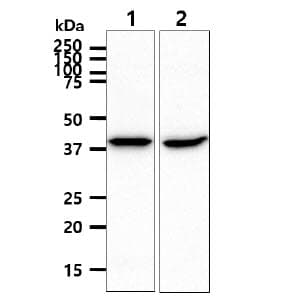 SCAD / ACADS Antibody (clone AT8B10)