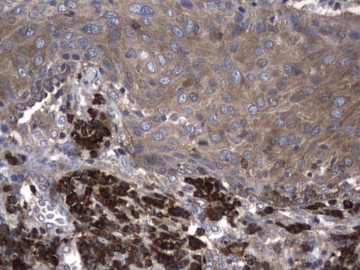 NME1 / NM23 Antibody (clone UMAB92, Carrier-free)