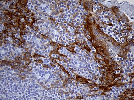 LAD1 Antibody (aa271-517, clone OTI7H8)