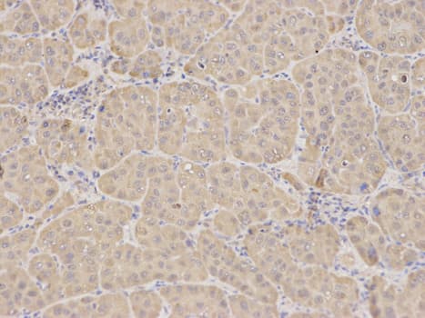 RICK / RIP2 Antibody