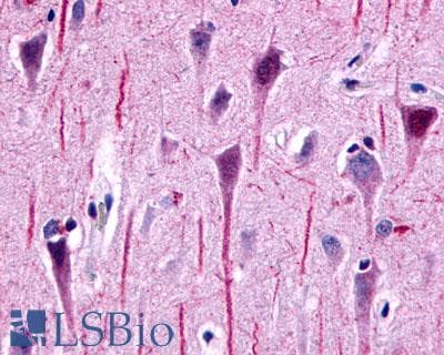 PathPlus™ GPR162 Antibody (Extracellular Domain)