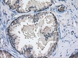 PDE4A / PDE4 Antibody (clone OTI7D11)