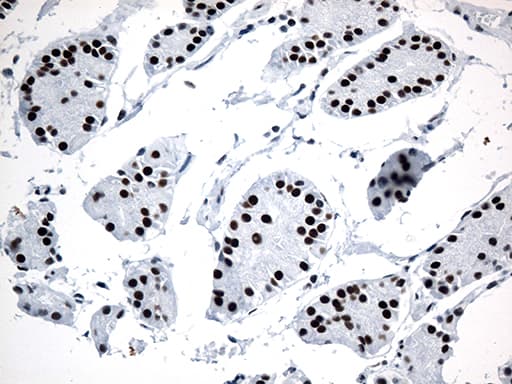 GTF3C4 Antibody (aa583-822, clone OTI3D4)