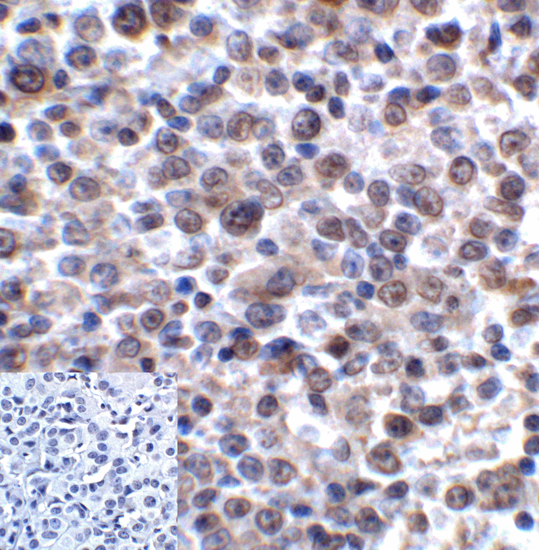 Monoclonal Mouse anti-Human LAG3 Antibody (clone 5F11, IHC, IF, WB)