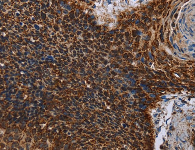 IDH2 Antibody