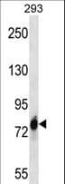 IHC-plus™ Polyclonal Rabbit anti-Human CDH16 / Cadherin 16 Antibody (aa796-824, IHC, WB)
