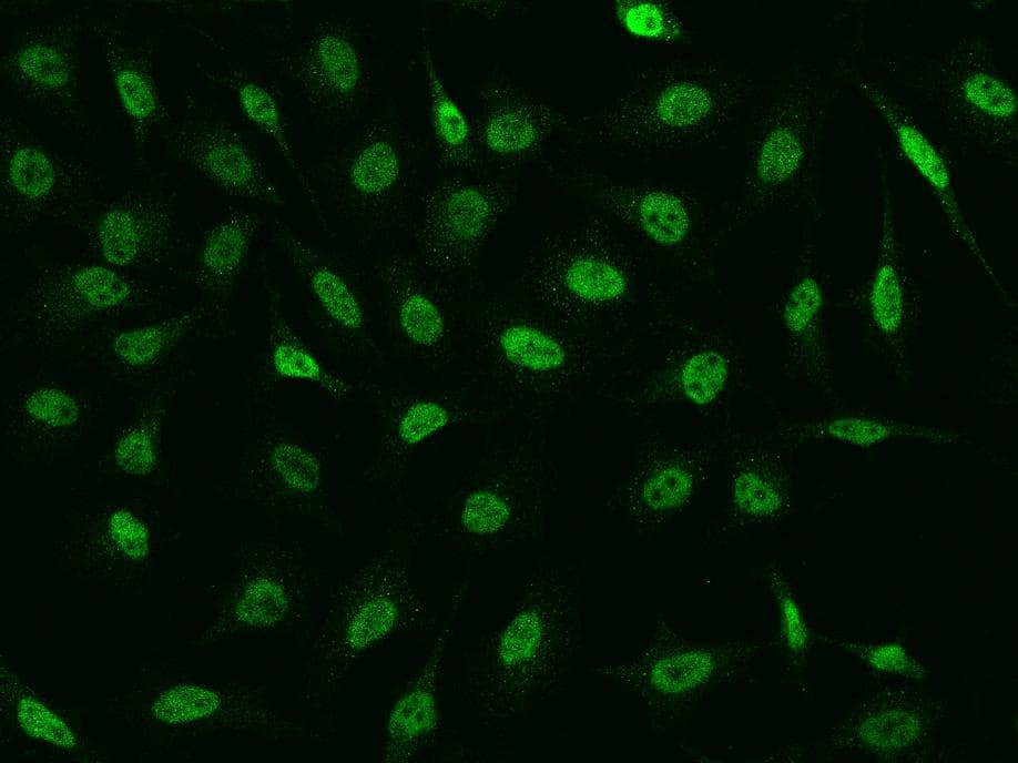 CHD4 Antibody
