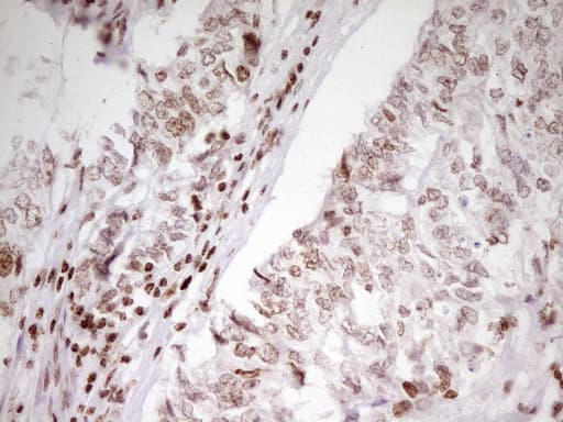 Monoclonal Mouse anti-Human SP110 Antibody (clone OTI4C1, aa232-521, IHC, WB)