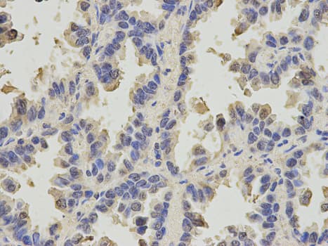 IHC-plus™ SLC4A4 / NBC1 Antibody