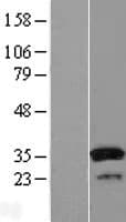 SULT1A1 / Sulfotransferase 1A1 Protein (Over-Expression Lysate Myc-DDK (Flag))