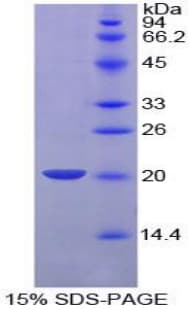 Pig PLAU / Urokinase / uPA Protein (Recombinant His-T7)