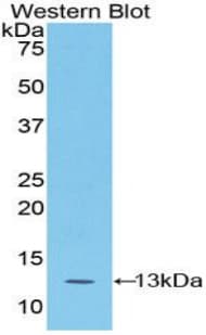 S100A4 / FSP1 Antibody (aa1-101, PE)