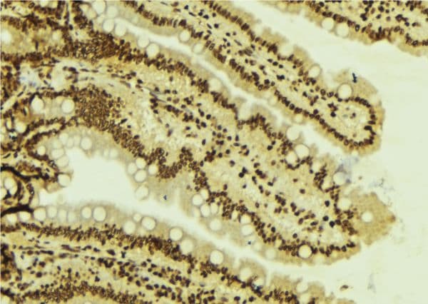 Polyclonal Rabbit anti-Human SMARCA4 / BRG1 Antibody (IHC, WB)