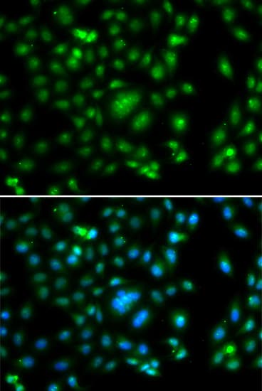 ELF5 Antibody
