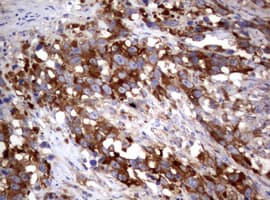 Monoclonal Mouse anti-Human PIK3C2A Antibody (clone OTI2C10, aa230-560, IHC, WB)
