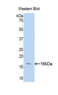 HTRA1 Antibody (aa204-364)