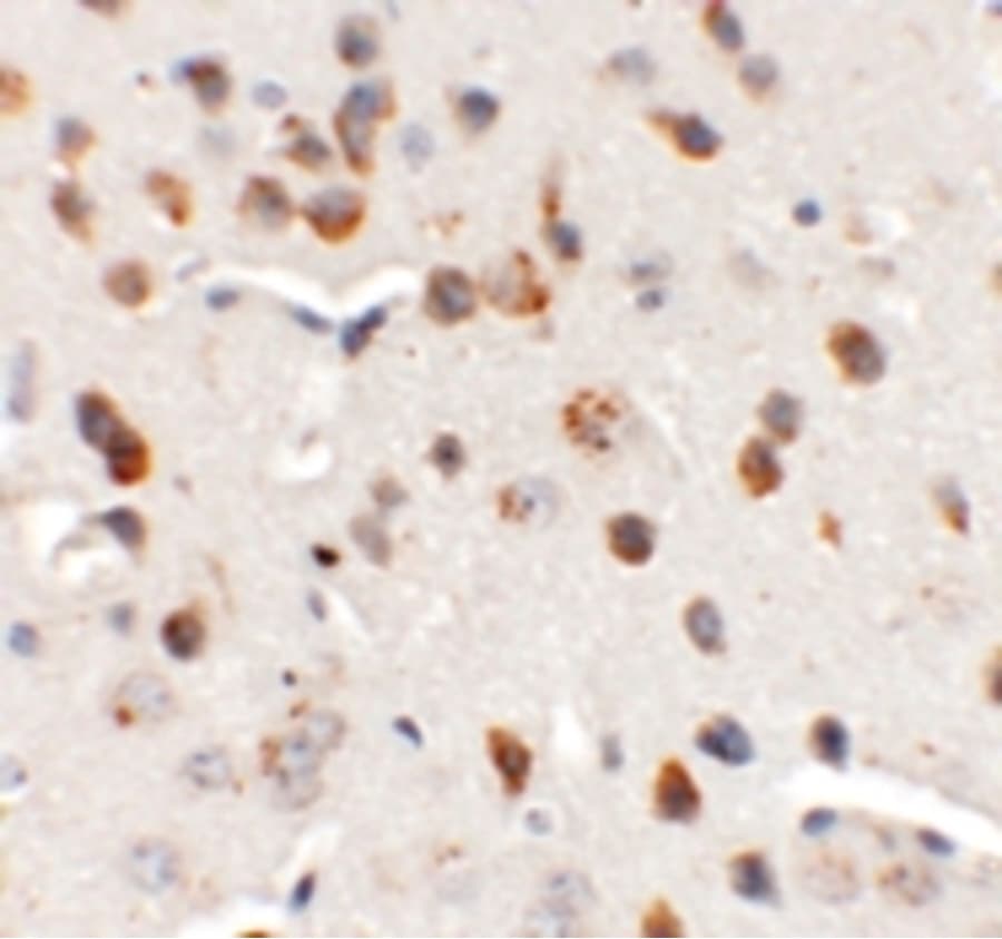 CHD7 Antibody