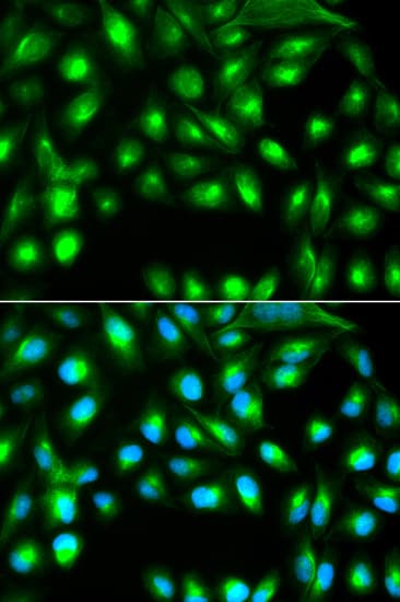 Polyclonal Rabbit anti-Human SIP1 Antibody (IHC, IF, WB)