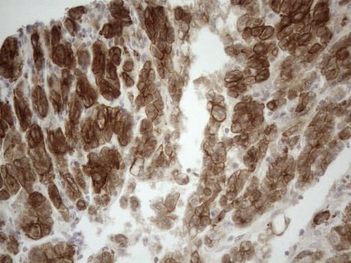 KRT18 / CK18 / Cytokeratin 18 Antibody (aa69-372, clone OTI2H10)