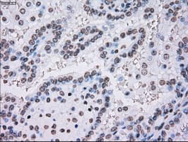PLK1 / PLK-1 Antibody (clone OTI5C1)