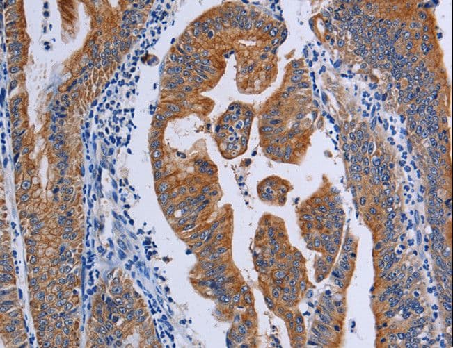 ACP6 Antibody