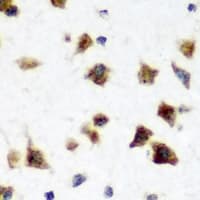 Polyclonal Rabbit anti-Human ELAVL3 / HUC Antibody (IHC, WB)