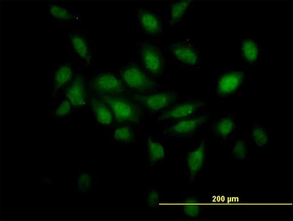 TCEB2 / Elongin B Antibody (clone 6F6)