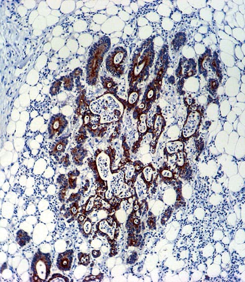 TGFB2 / TGF Beta2 Antibody