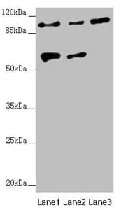 TTLL7 Antibody