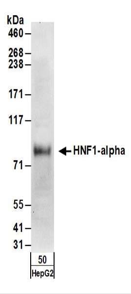 IHC-plus™ Polyclonal Rabbit anti-Human HNF1A / HNF1 Antibody (aa550-600, IHC, WB)
