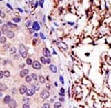 UBE2L3 / UBCH7 Antibody (aa1-30)