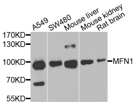Polyclonal Rabbit anti-Human MFN1 Antibody (WB)